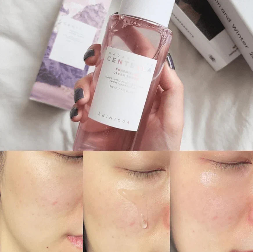 SKIN 1004 madagascar centella poreminzing clear tonner